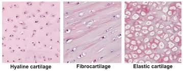 <p>A type of connective tissue that is more flexible than bone, providing support and cushioning to joints, and is found in structures like the nose, ears, and between vertebrae. </p>