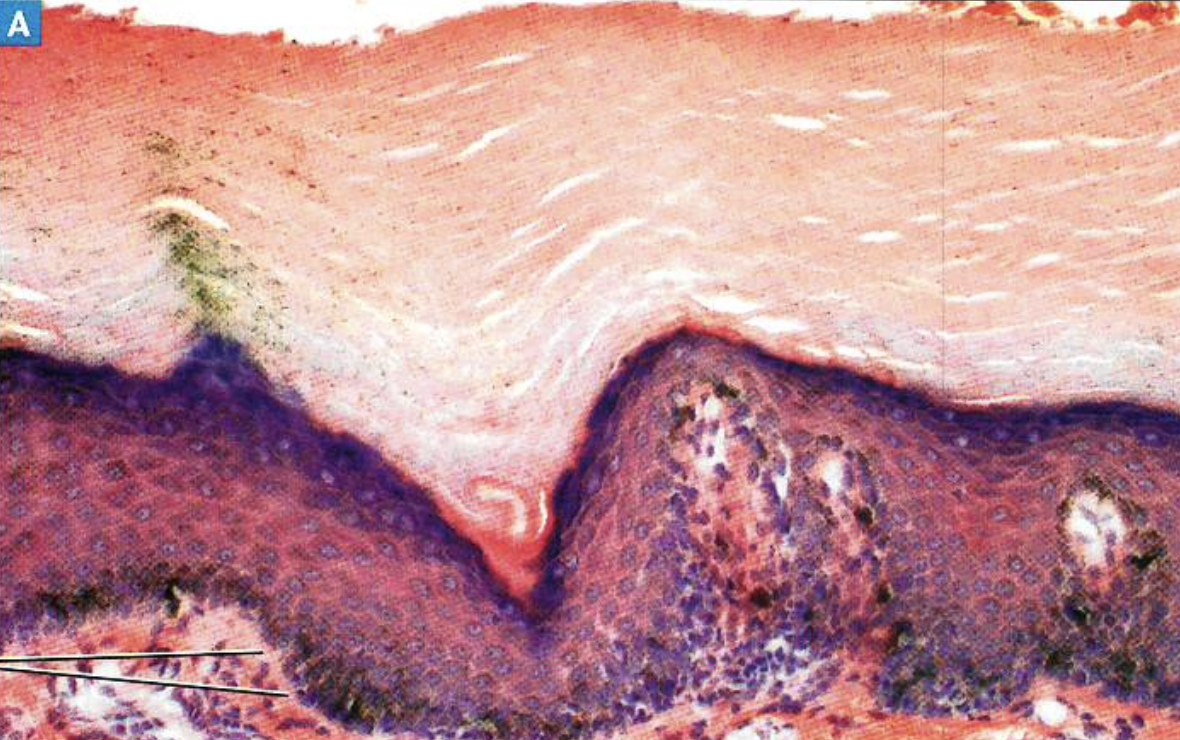 <p>What type of tissue is present in this image?</p>