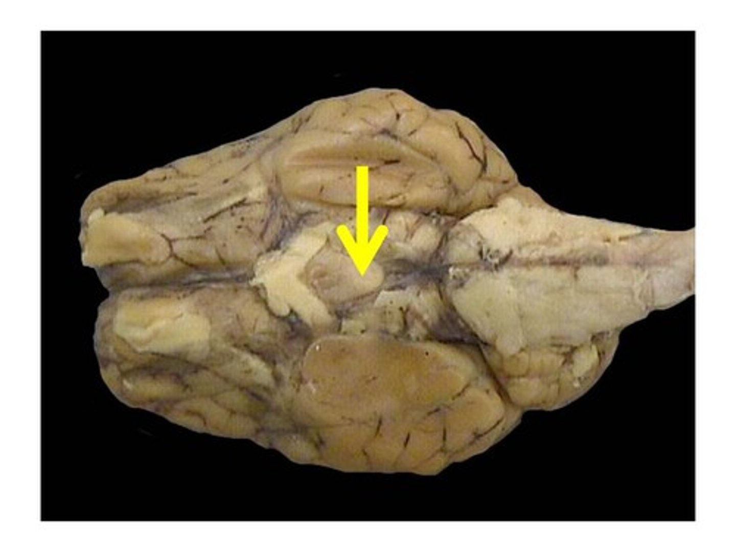 <p>Memory relay nuclei</p>