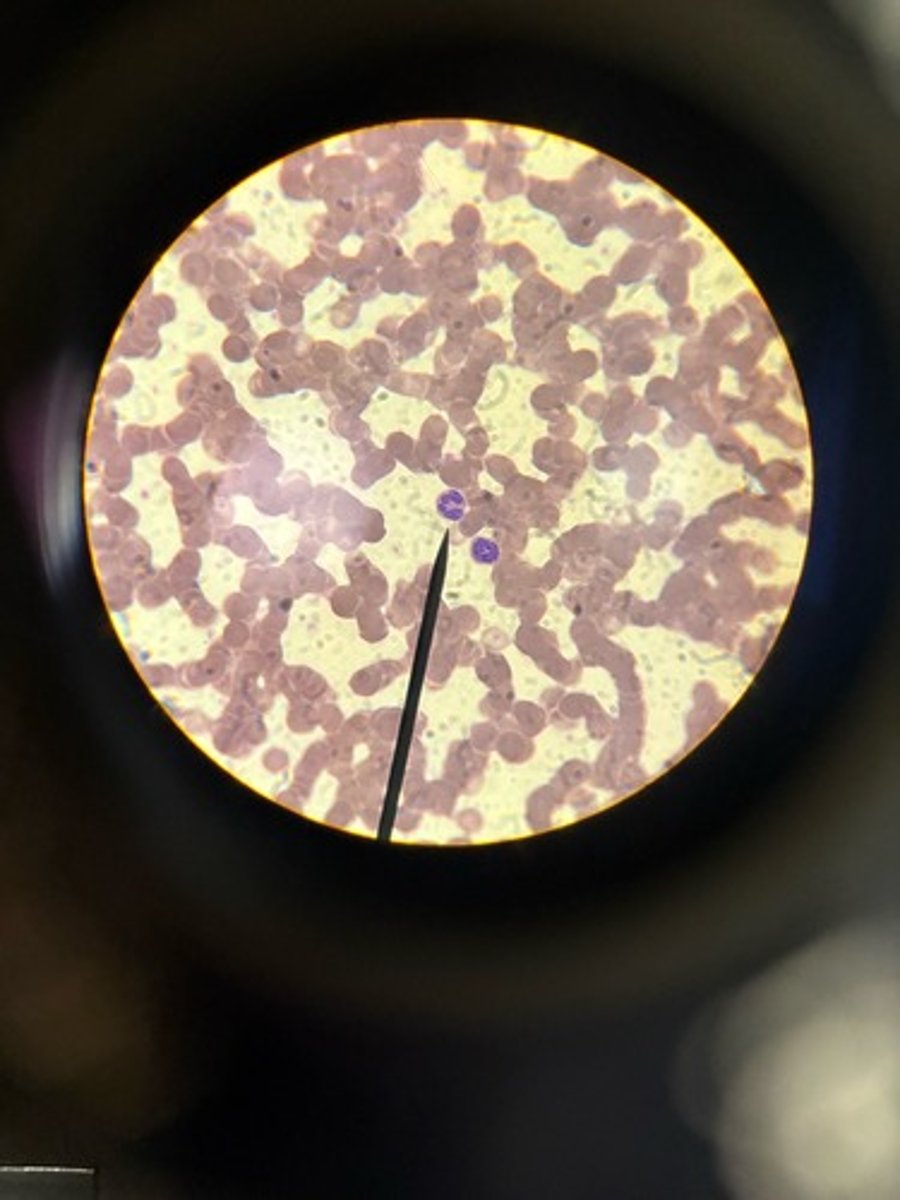 <p>Identify</p>