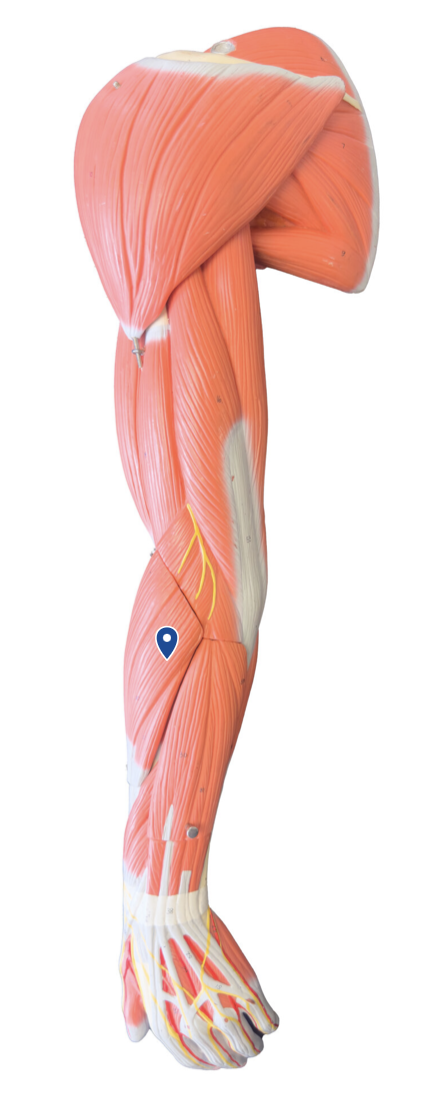 <p>What muscle is the arrow pointing to?</p>