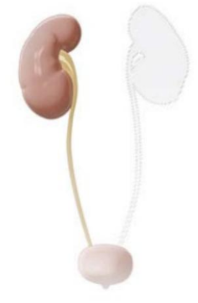 <p>Complete non-appearance of the organ</p>