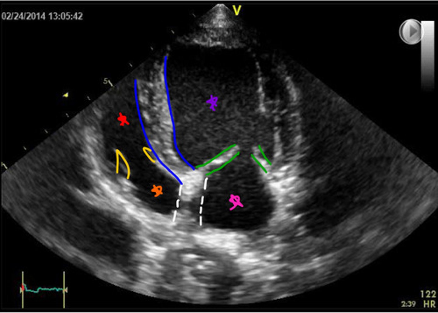 <p>ID parts of heart</p>