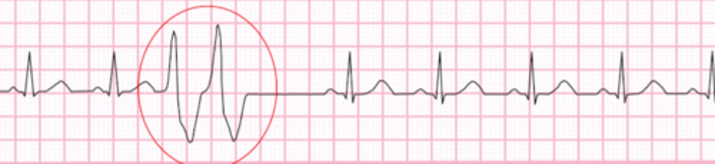 <p>Name the rhythm</p>