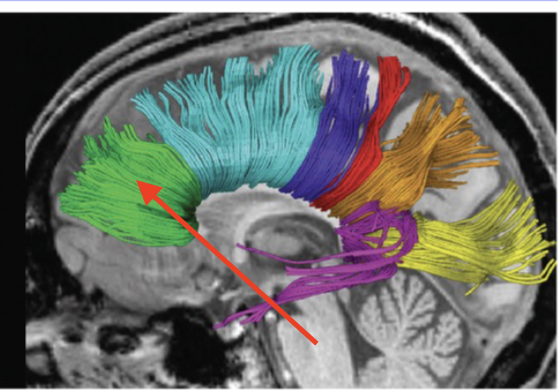 <p>connects anterior right and left frontal lobe</p>