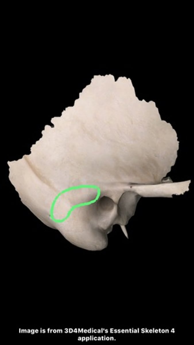 <p>Posterior extension of the suprameatal crest</p>