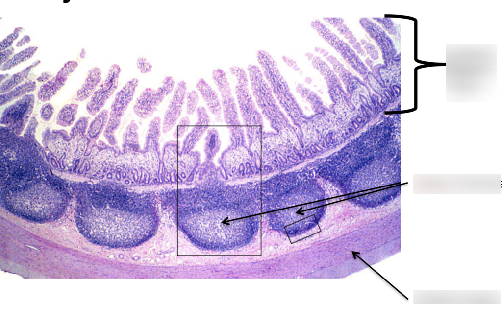 <p>prevent bacterial infection in the small intestines, located in the mucous membrane</p>