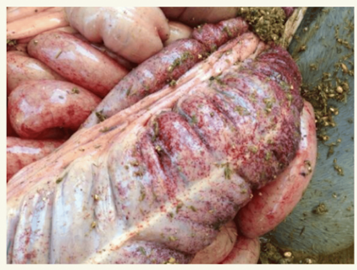 <p>shock séptico</p><p>peritonitis</p><p>contaminación de la cavidad abd</p>