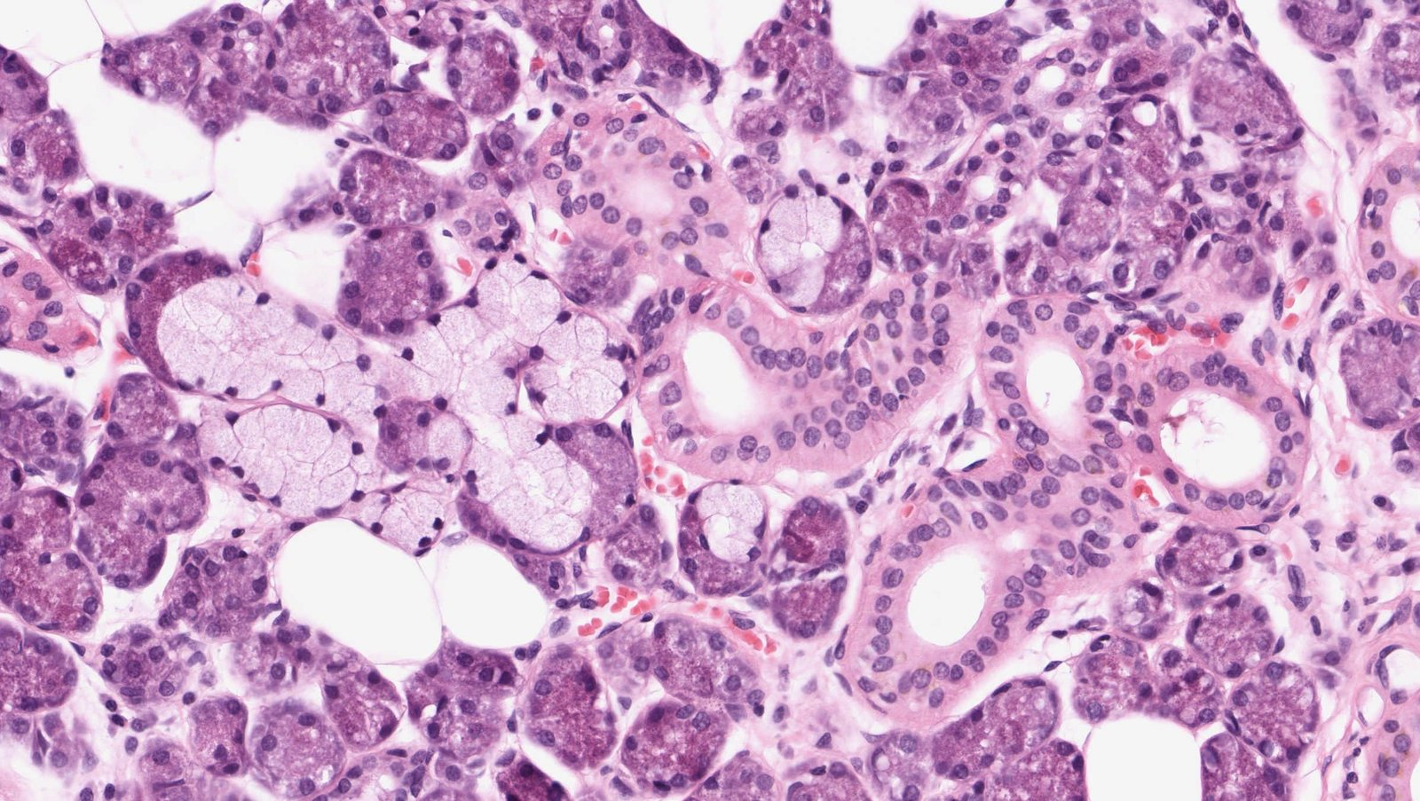 <p>D. A section of the submandibular gland (Glandula submandibularis)</p>