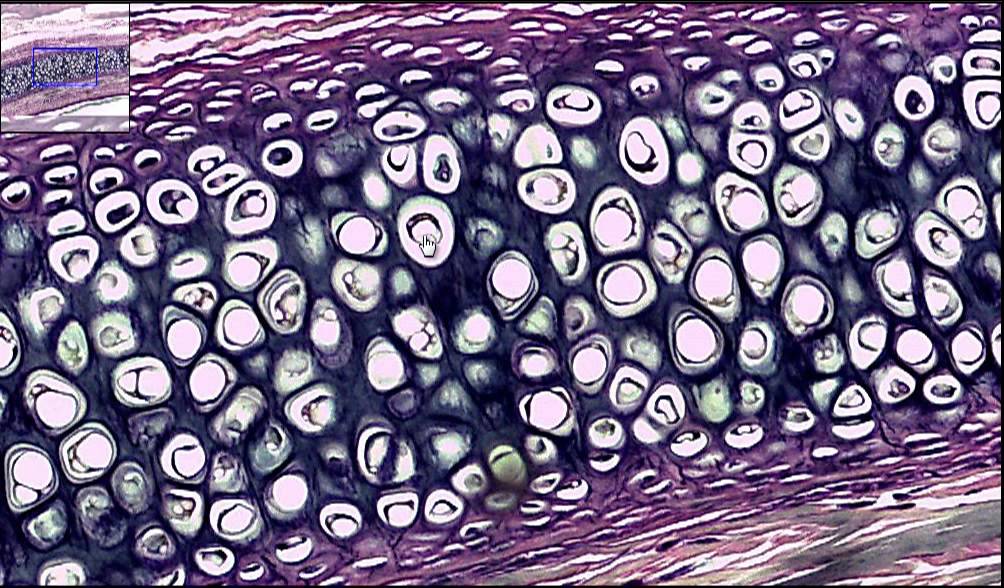 <p>Is this fibrocartilage, hyaline cartilage, or elastic cartilage?</p>