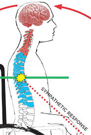 <p><strong>If the nurse suspects a spinal cord injury, the patient has developed autonomic dysreflexia. Which of the following assessments would confirm this complication? Select all that apply.</strong></p><p>A) BP 180/98</p><p>B) Skin covered with macular rash</p><p>C) Pulse rate 49</p><p>D) Complains of a pounding headache</p><p>E) Cold, cyanotic lower legs </p>