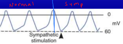 <ul><li><p>causes depolarization to occur more rapidly</p></li><li><p>steeper </p></li><li><p>faster heartbeats</p></li></ul>