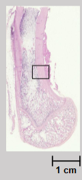 <p>Name the pale pink structure in this image that runs around the outside of the bone:</p>