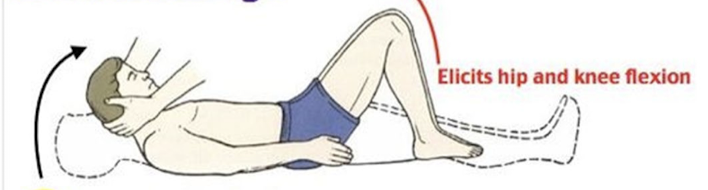 <p>Passive flexion of neck, causes a hip &amp; knee flexes</p>