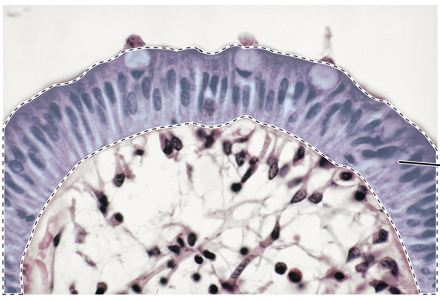 <p>Name the highlighted tissue.</p>