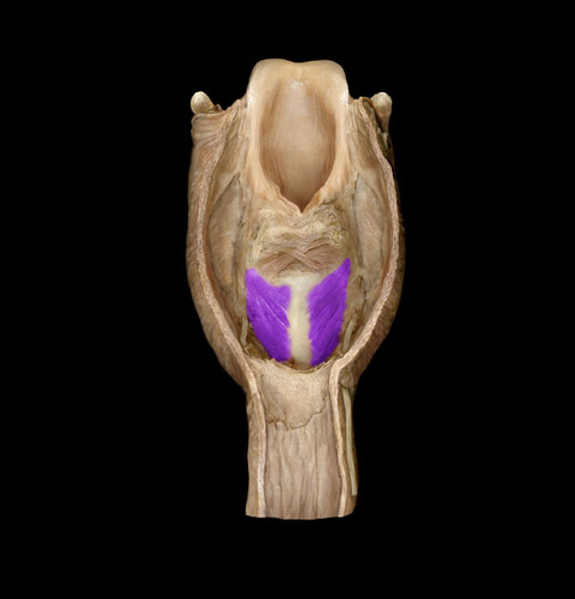 <p>Name the Muscle</p>