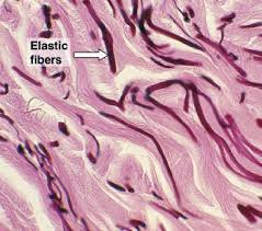 <p><strong>abundant</strong><span style="color: blue"><strong> elastic fibers</strong></span></p><p>( more than collagen fibers ) </p>