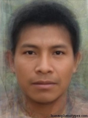 <p>Identify this Phenotype</p>