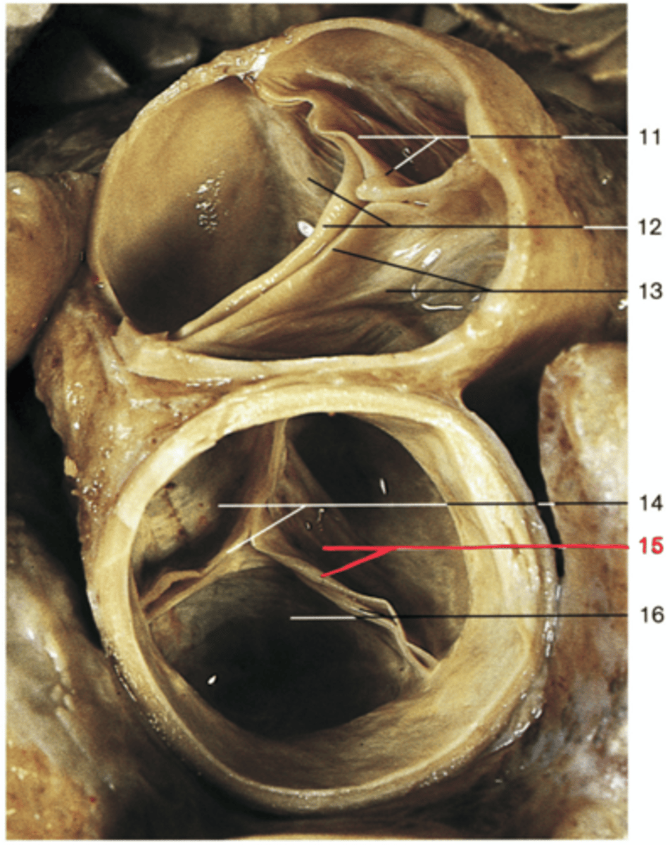 <p>Name the Structure of the Left Ventricle</p>