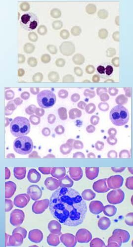 <p>wbc abnormalities</p>
