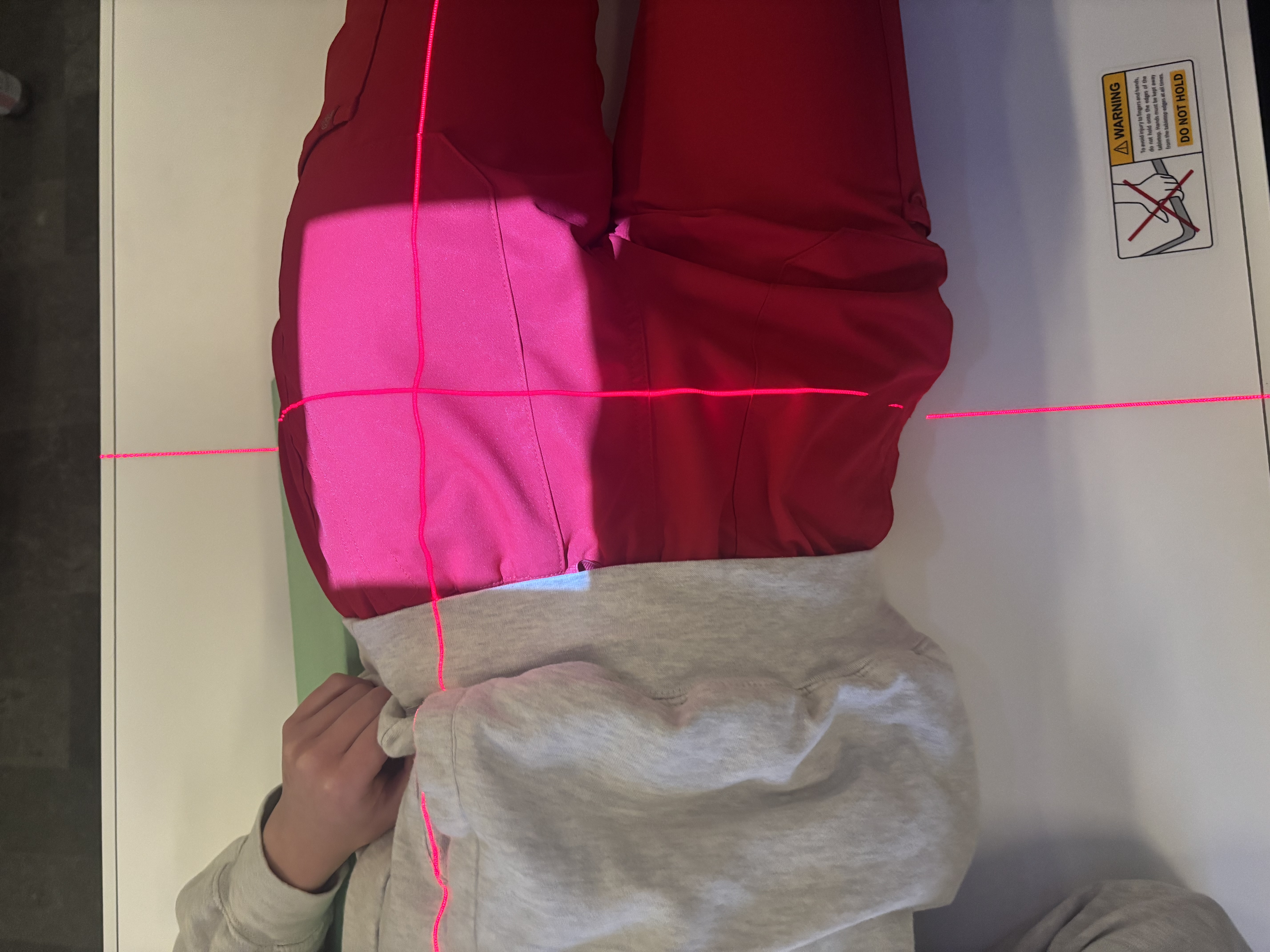 <p>Posterior Oblique Judet (Upside)</p>