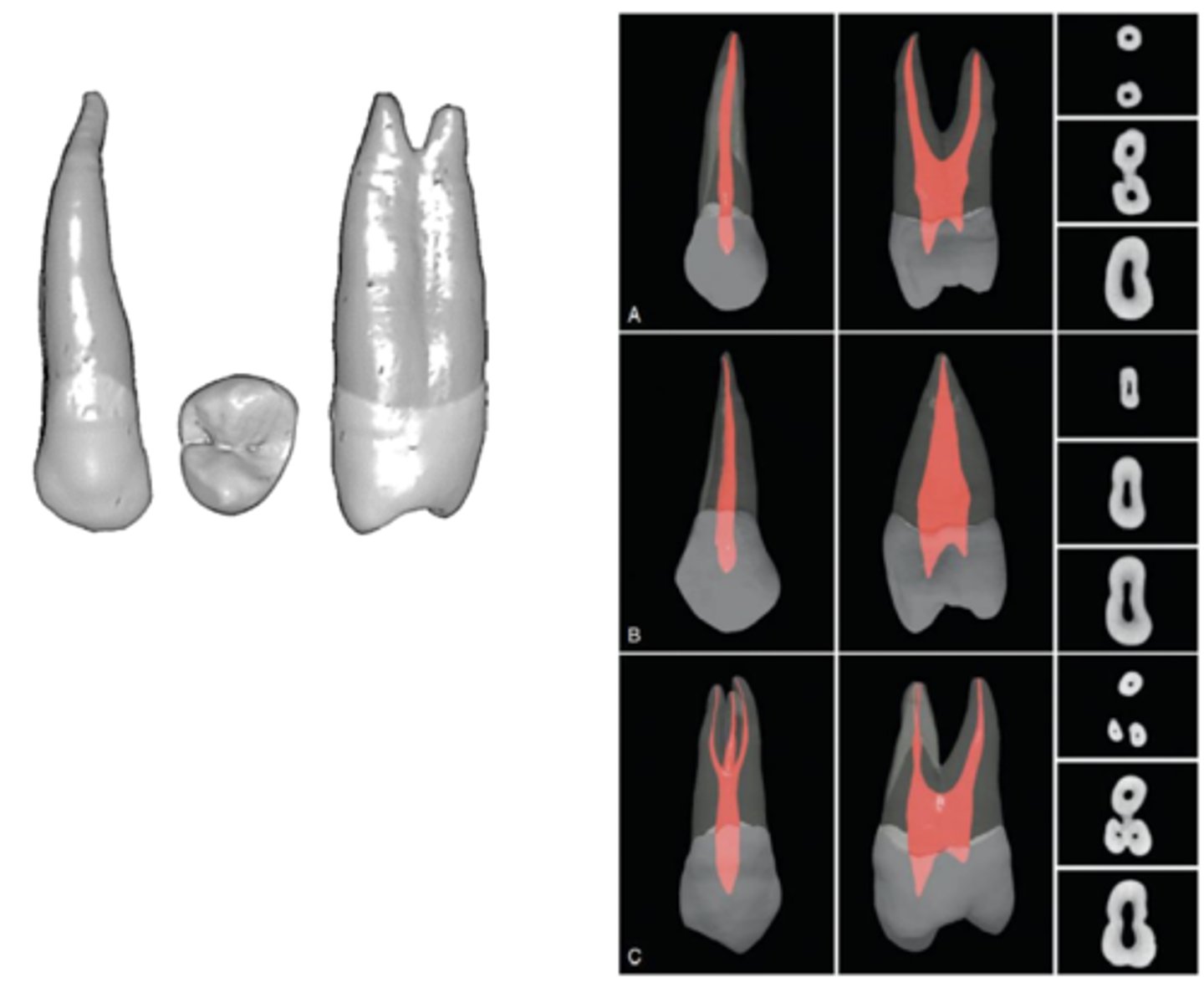 <p>mesial</p>
