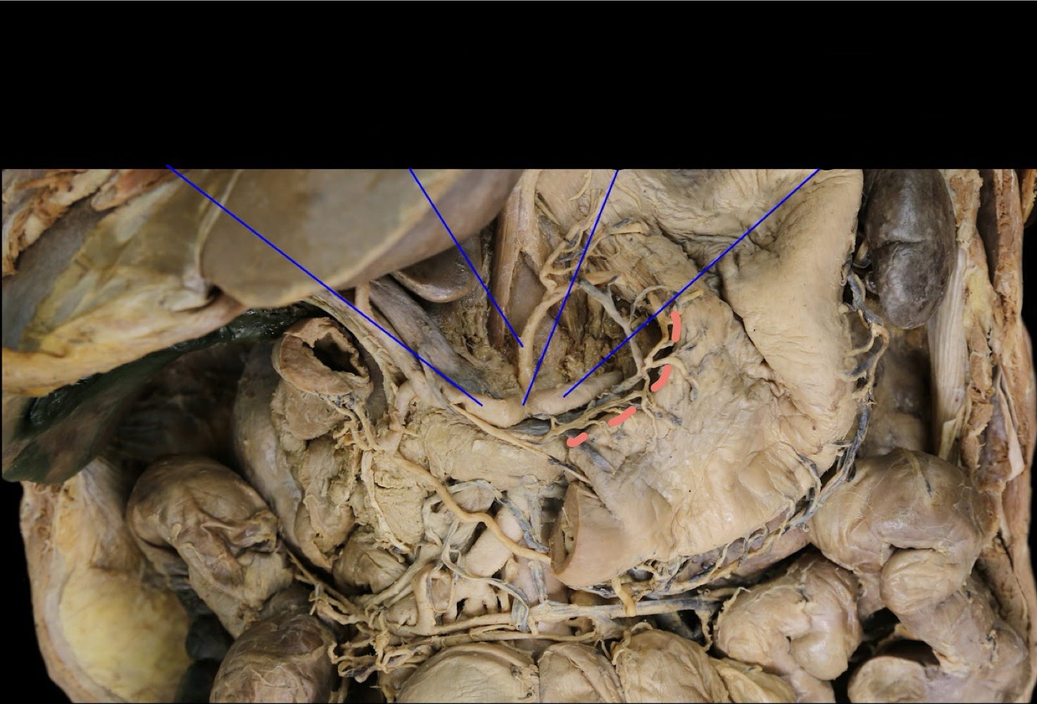 <p>A). Identify this structure<br>B). What supplies blood to this structure?</p>