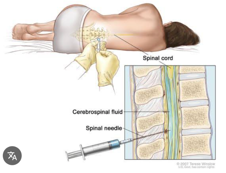 <p>It is used to obtain cerebrospinal fluid for analysis. The fluid is assessed for each of the following characteristics.</p>