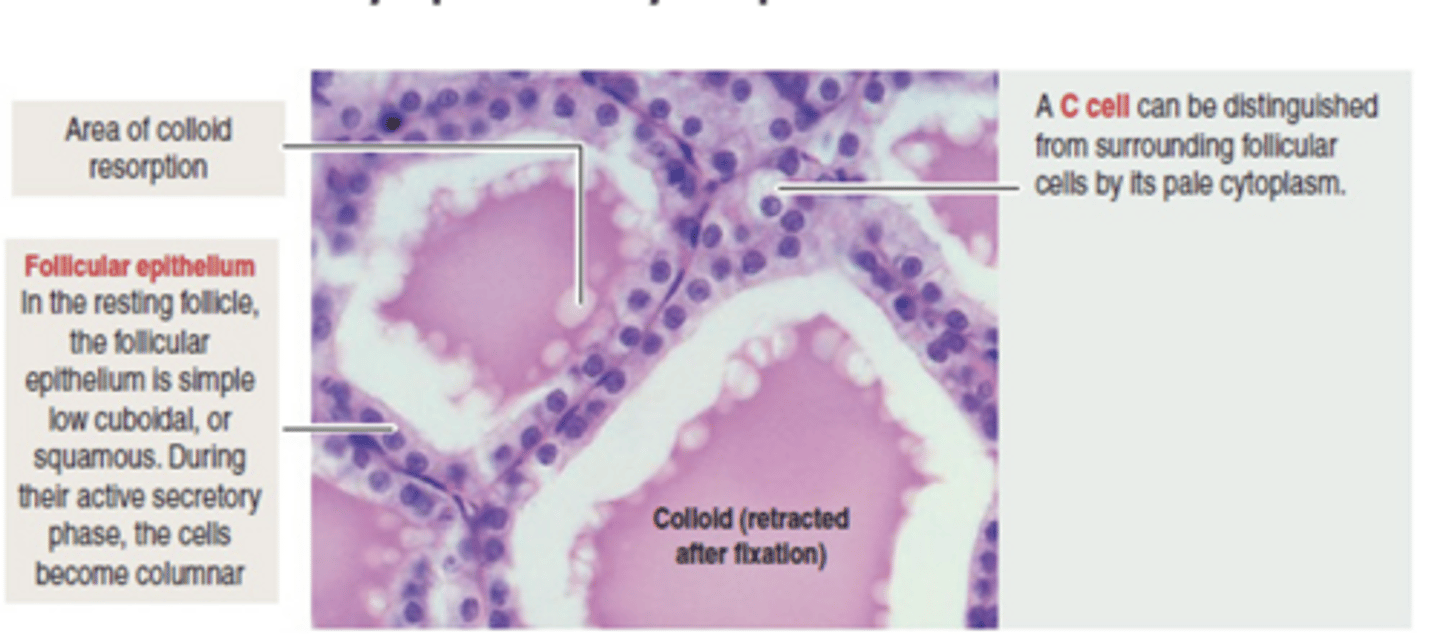 <p>thyroid histo:</p>