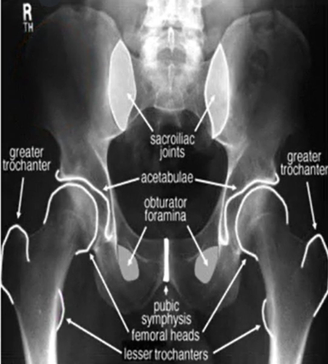 <p>IR 15-20 degrees</p>
