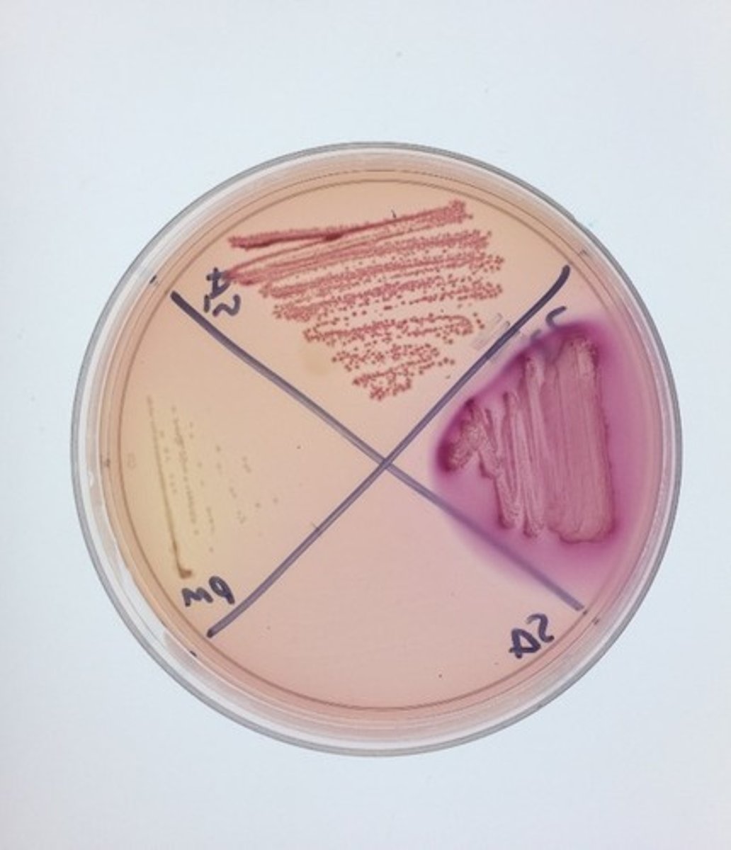 <p>MAC</p><p>Selective:</p><p>Differential:</p><p>Dyes/Reagents:</p>