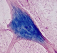 <p>Which type of tissue does this image depict?</p>