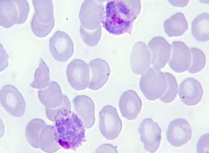 Gametocyte Plasmodium vivax