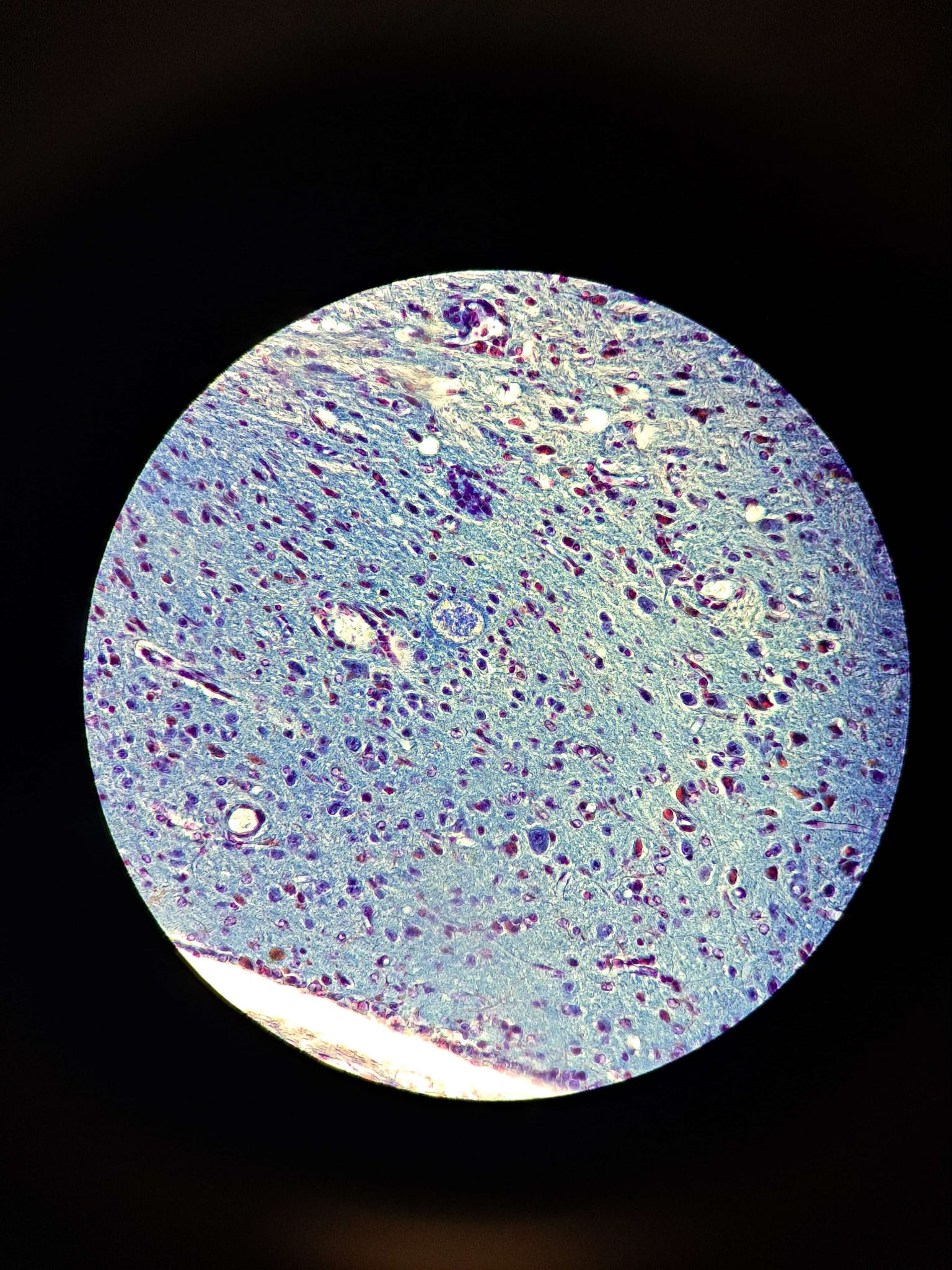 <p><span data-name="microscope" data-type="emoji">🔬</span><span data-name="petri_dish" data-type="emoji">🧫</span><strong><span> </span>Na podstawie zdjęcia preparatu:</strong></p><p></p><ul><li><p><span data-name="book" data-type="emoji">📖</span><span> </span>rozpoznaj gatunek pasożyta;</p></li></ul><p></p><ul><li><p><span data-name="recycle" data-type="emoji">♻</span><span> </span>rozpoznaj wszystkie formy rozwojowe;</p></li></ul><p></p><ul><li><p><span data-name="microbe" data-type="emoji">🦠</span><span> </span>wskaż organelle i cechy charakterystyczne dla danego gatunku;</p></li></ul><p></p><ul><li><p><span data-name="mask" data-type="emoji">😷</span><span> </span>nazwij chorobę, którą pasożyt wywołuje.</p></li></ul><p></p>