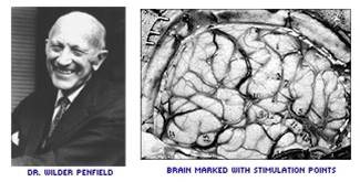 A surgical procedure to treat epilepsy, originally developed by Wilder Penfield, in which the neurons that produced seizures were surgically destroyed.
