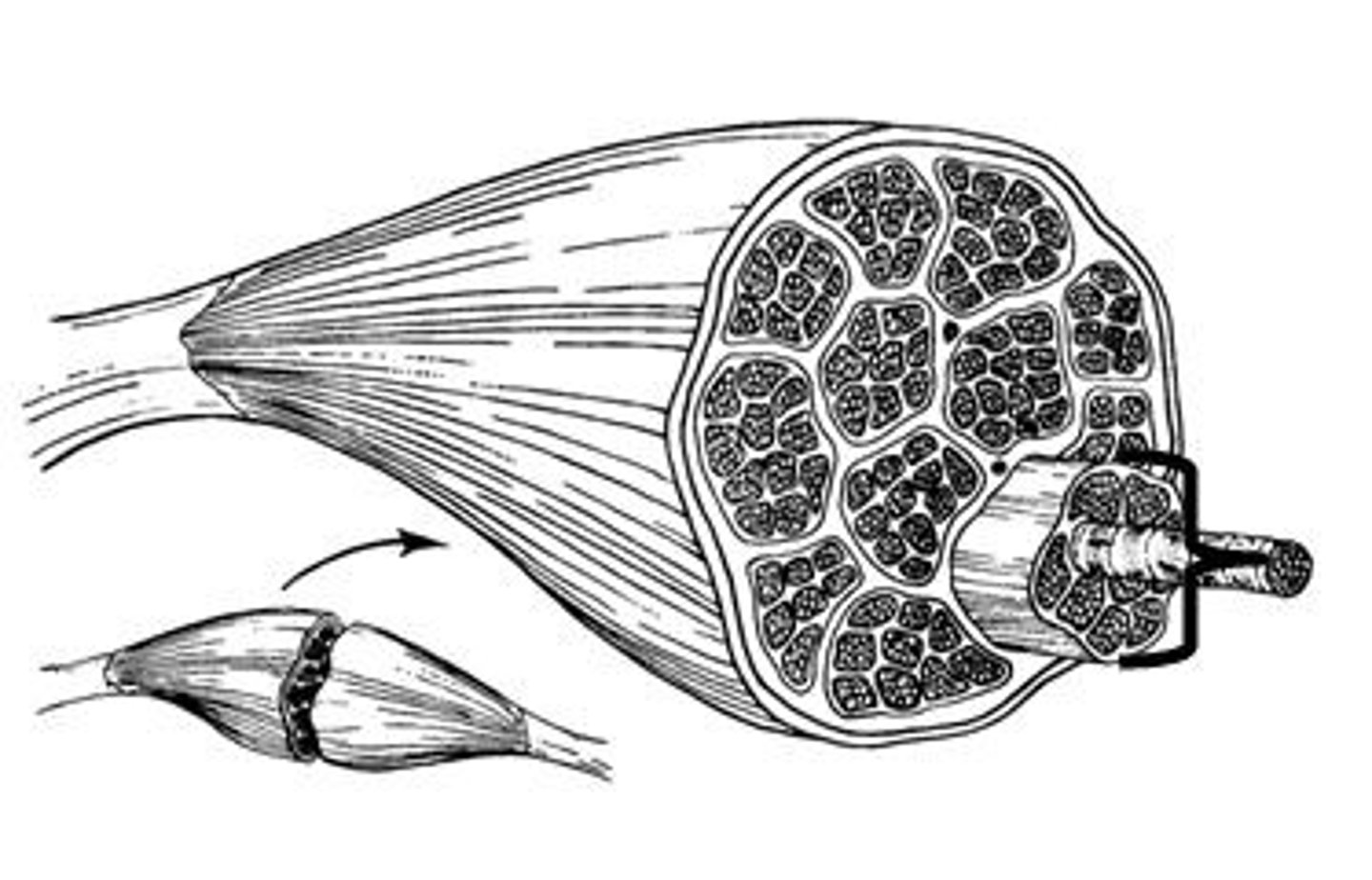 <p>Consists of bundles of muscle fibers</p>