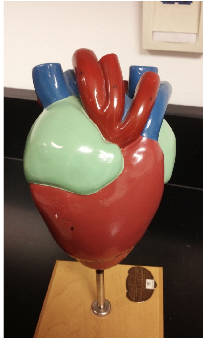 <p>What kind of heart is this? </p>