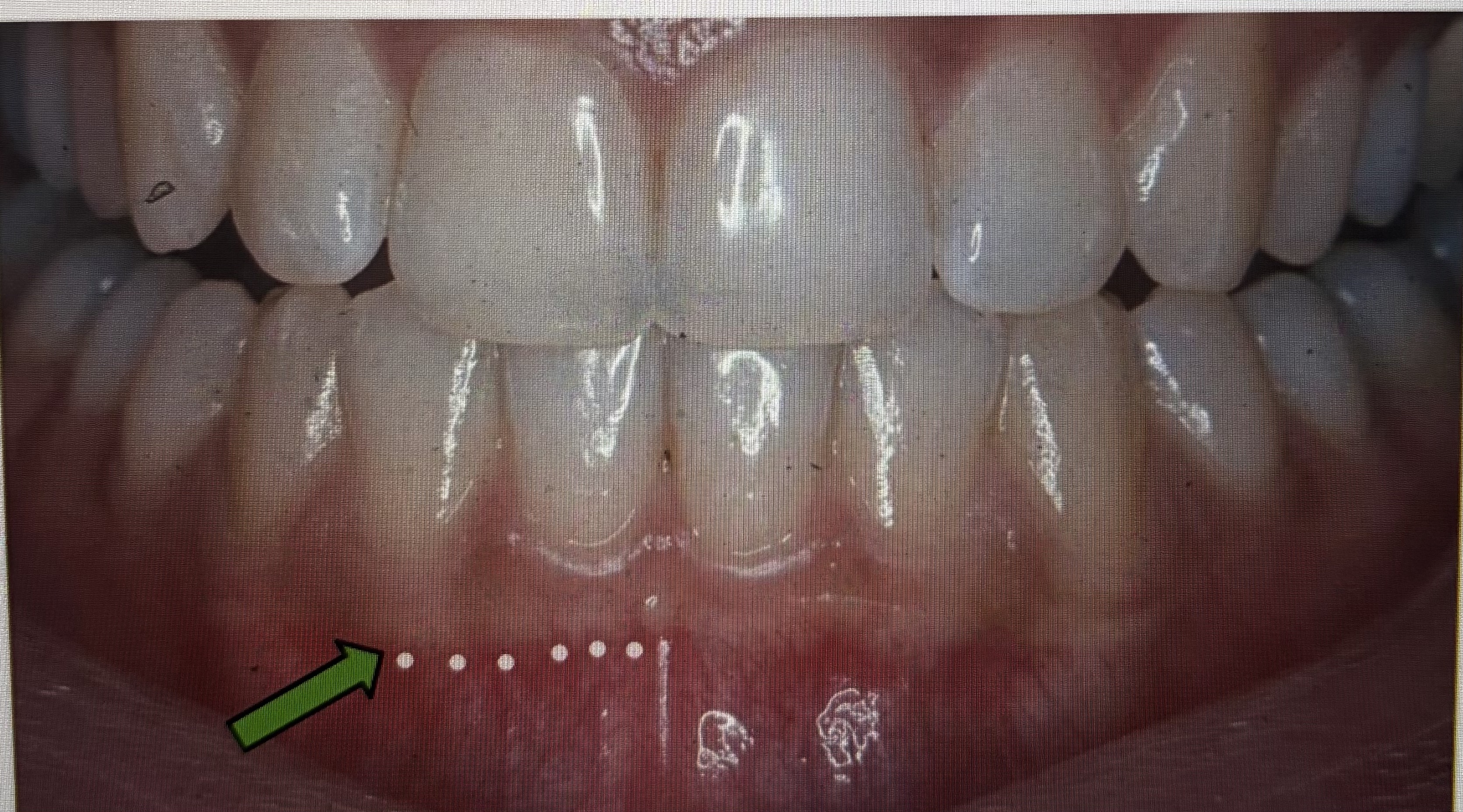 <p><span><span>Which part of the gingiva is the arrow pointing to?&nbsp;</span></span></p>