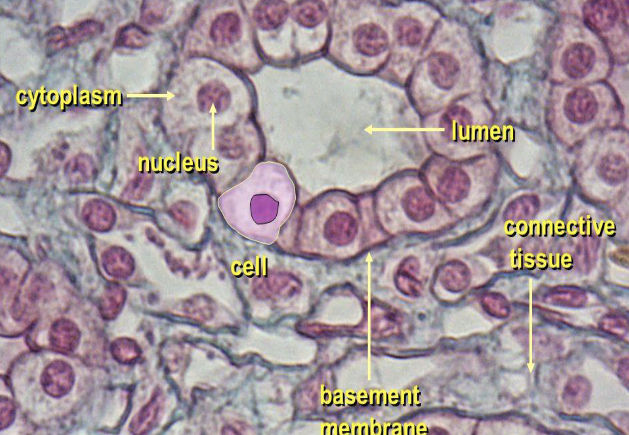 <p>What type of tissue is present in this image?</p>