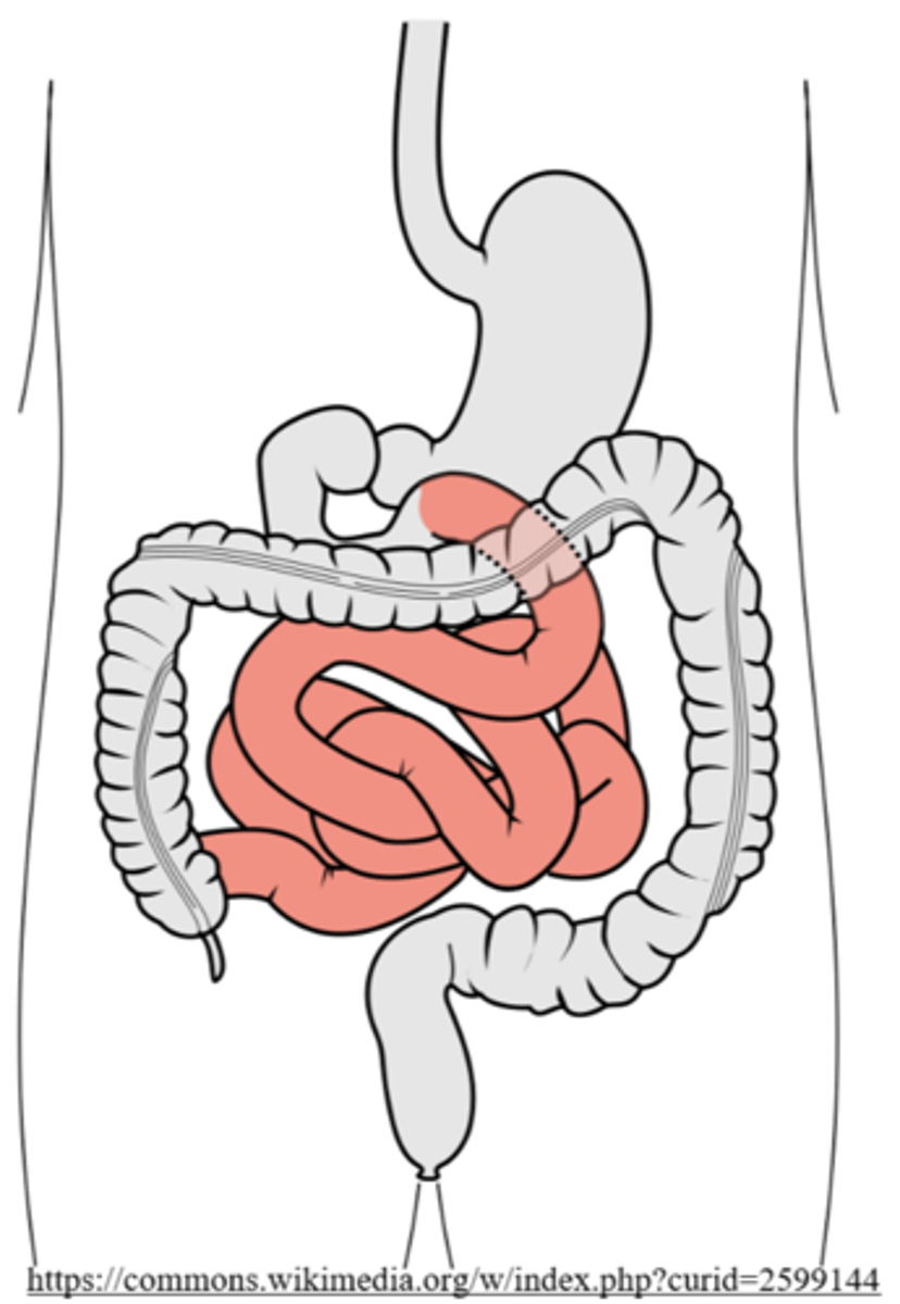 <p>absorption</p>