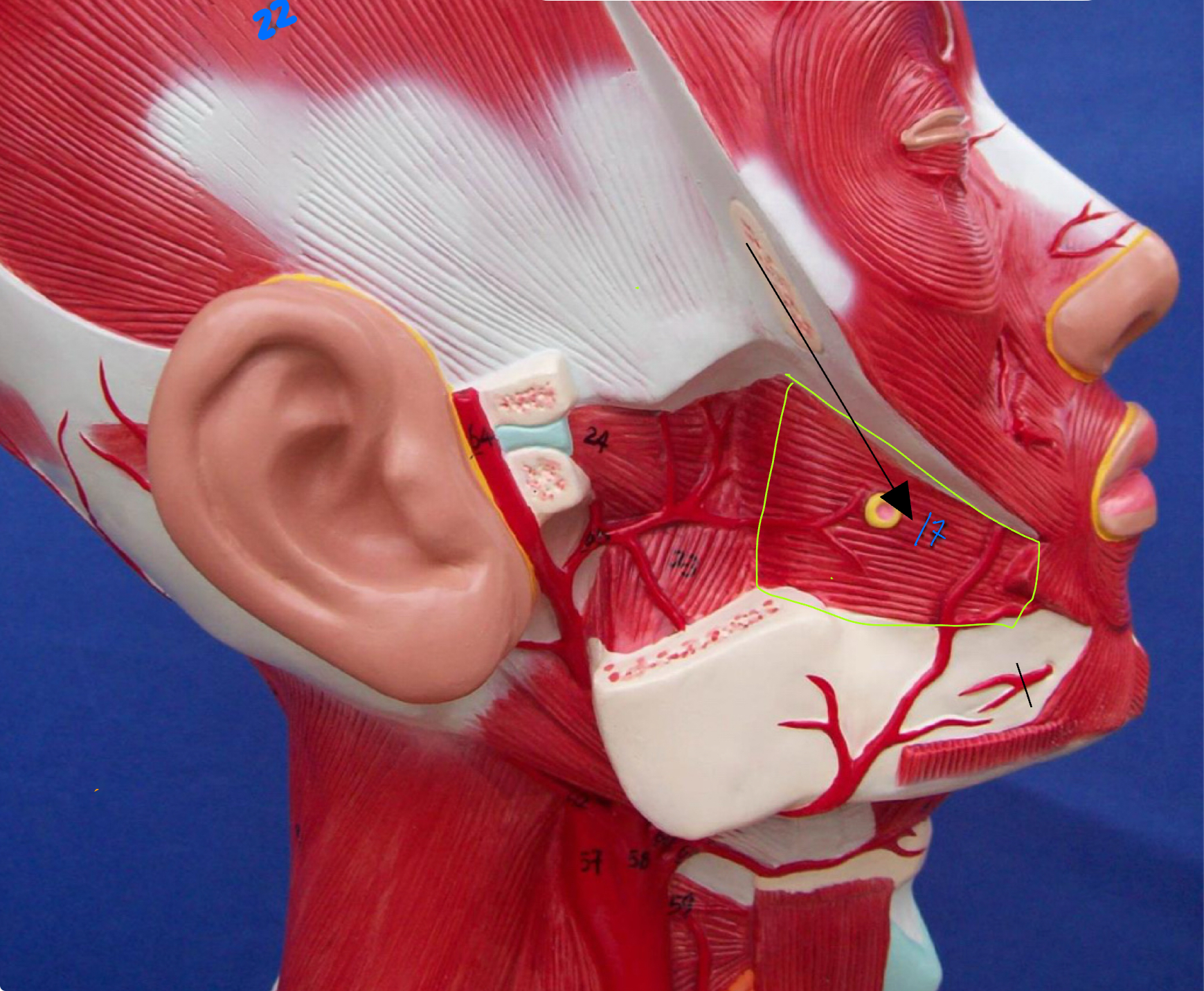 <p>What type of muscle is this (altay model )</p>