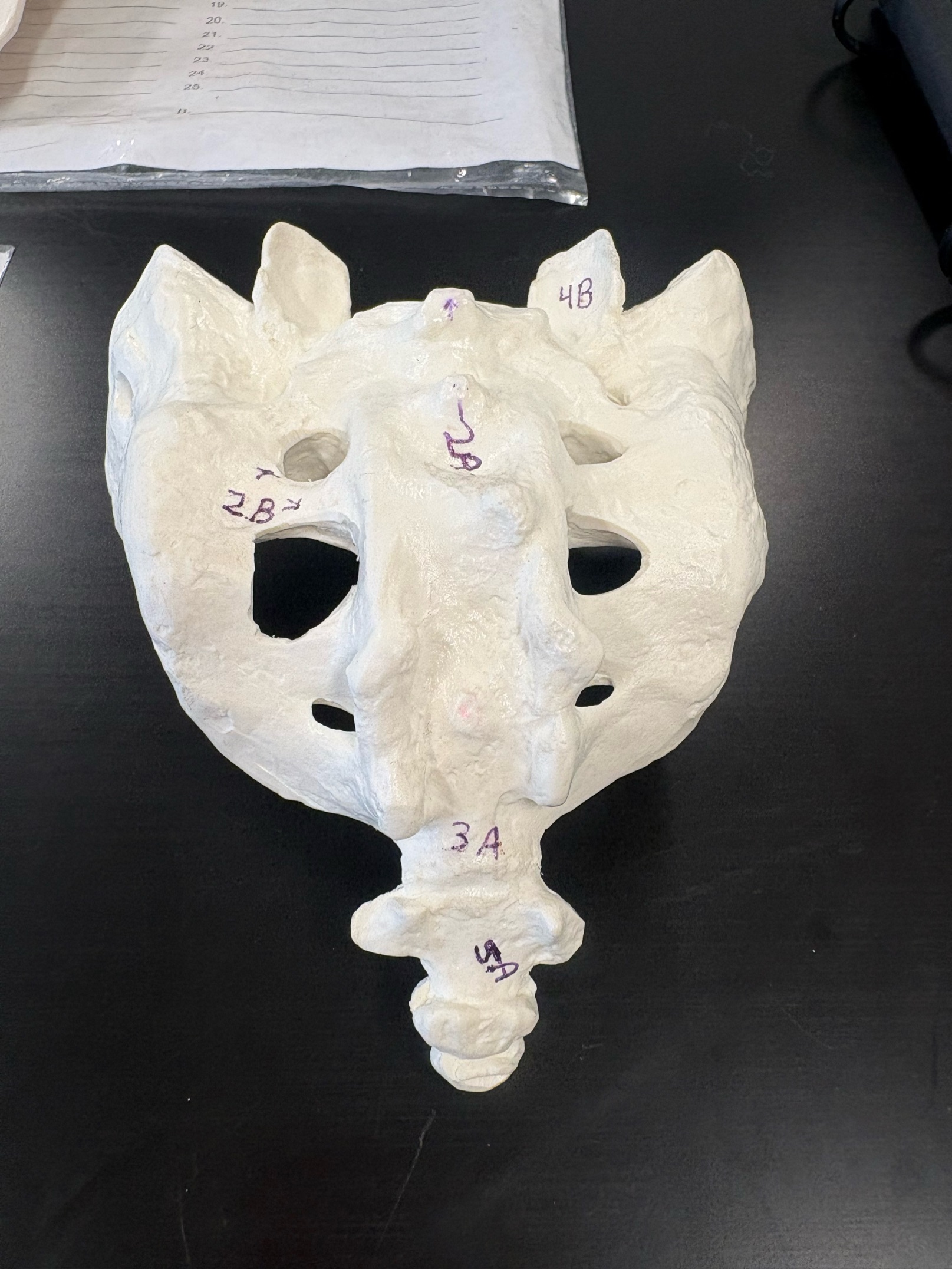 <p>Name this bone</p>