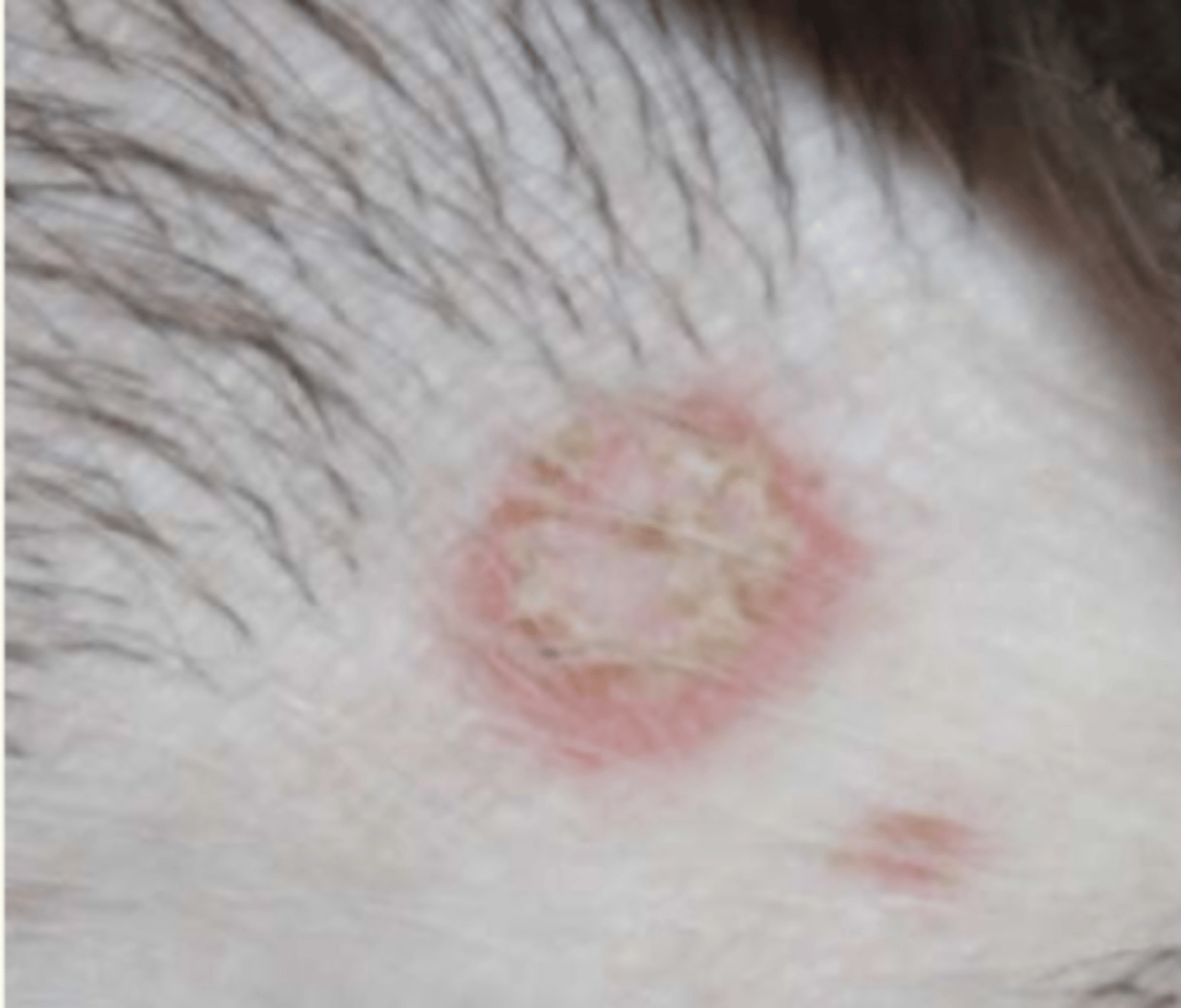 <p>¿lesión?</p><p>¿primaria o secundaria?</p>