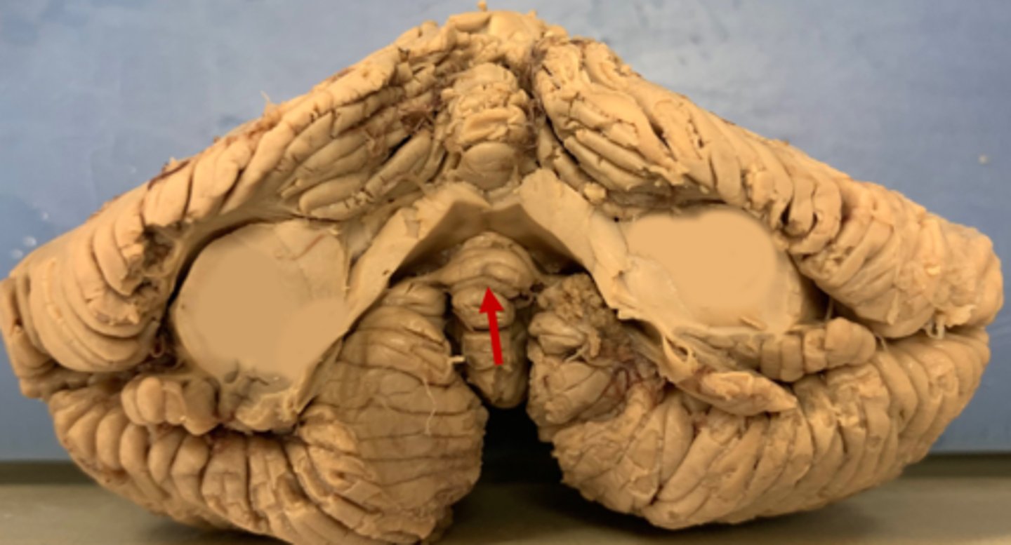 <p>What is this bottom area of the vermis called? (red arrow)</p>