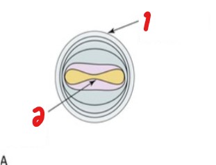 <p>Label which shapes are a certain transmural pressure.</p>