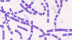 <p>what bacteria is this</p>