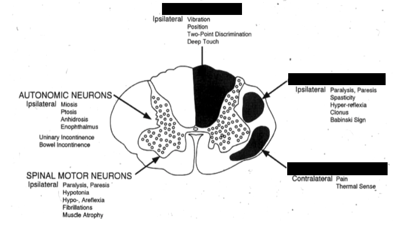 <p>what tracts/pathways are located where?</p>
