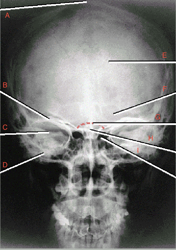 <p>what is A pointing to? </p>