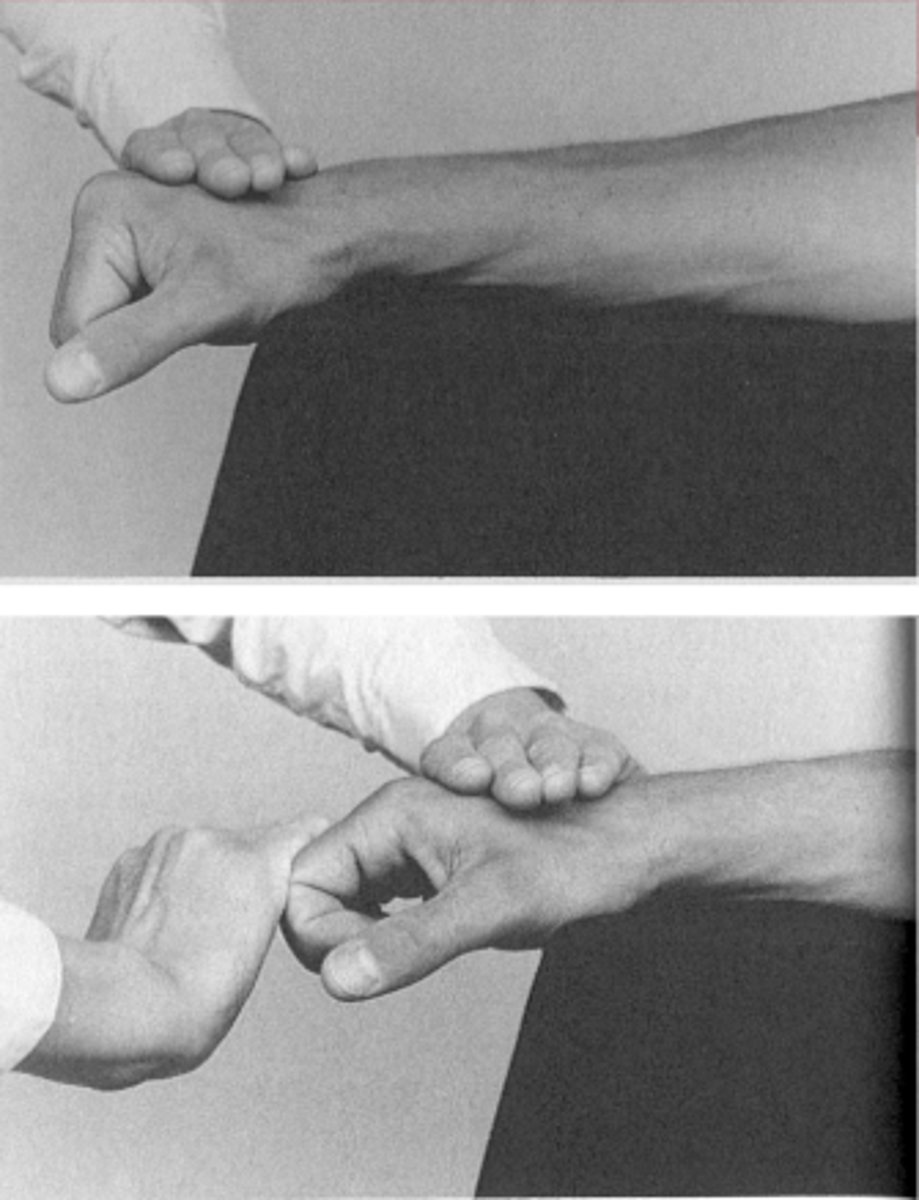 <p>Fő működés: MCP extensio</p><p>KH: könyök enyhe flexio, alkar pronáció, csukló a metacarpusig alátámasztva, az ujjak lelógnak, MCP flexioban</p><p>Rögzítem a metacarpust</p><p>Kérek egy MCP extensiot</p><p>Ellenállás: egyszerre, egész kezem a proximalis phalanxokra, extensioval szemben</p>