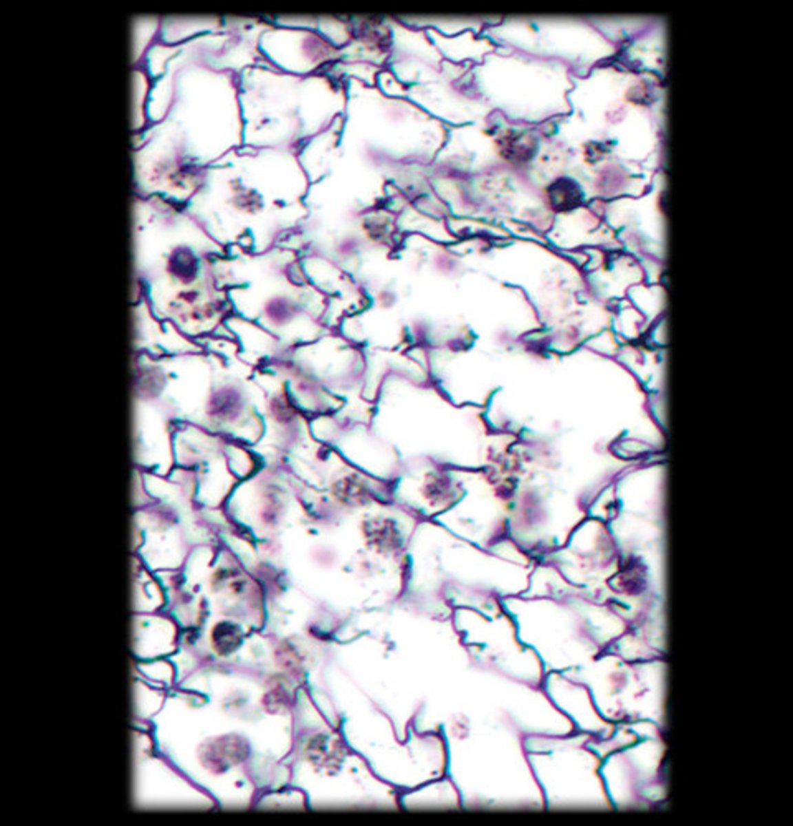 <p>- Network of thin, branching reticular fibers.</p><p>- Appears as a dark, web-like network of fibers under the microscope.</p><p>- Forms the supporting framework of organs like the liver, spleen, and lymph nodes.</p>